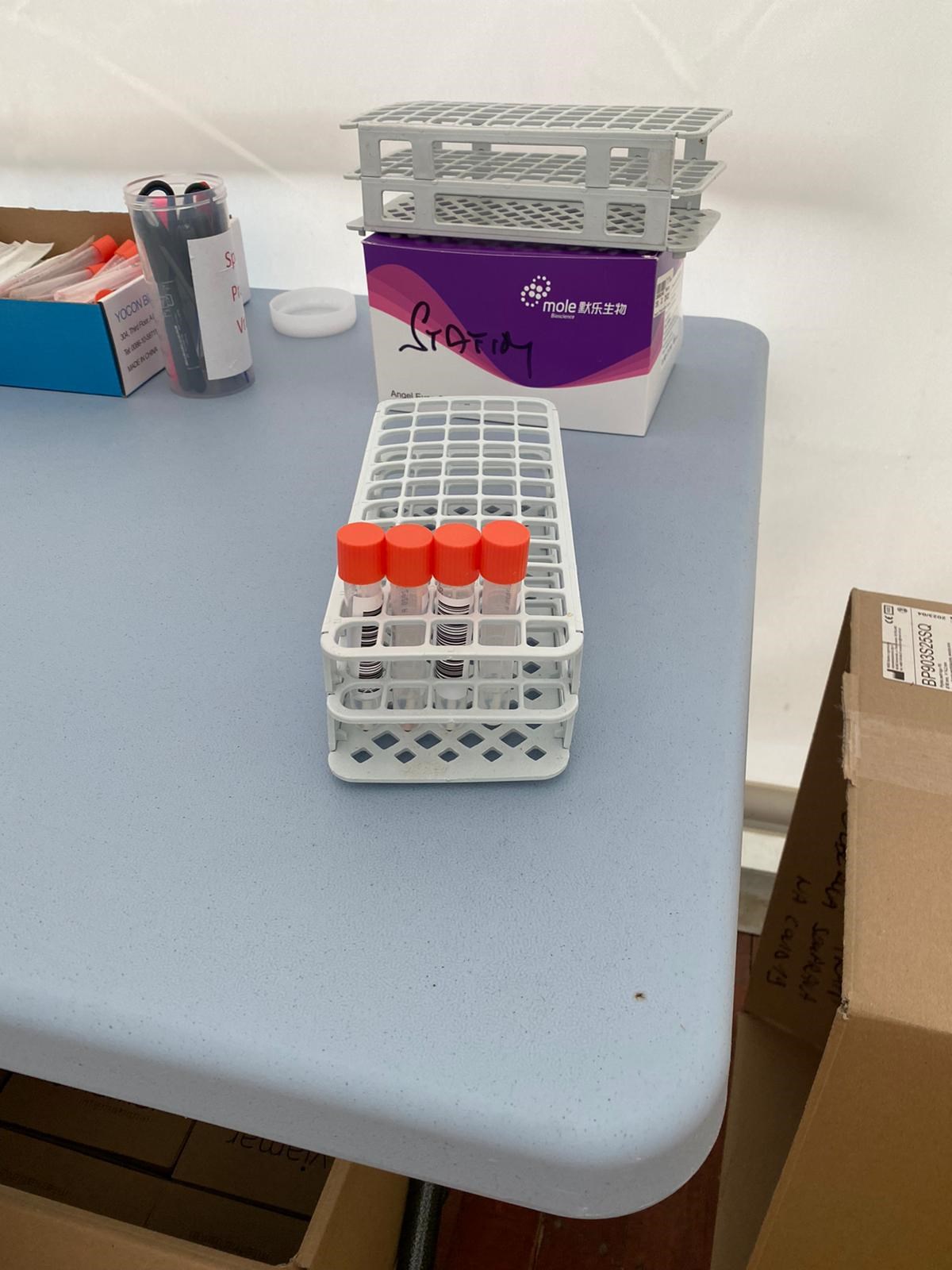 Test PCR na SARS CoV-2 je možné znovu absolvovat v mobilní buňce SPADIA LAB u Žlutých lázní v Praze-Podolí